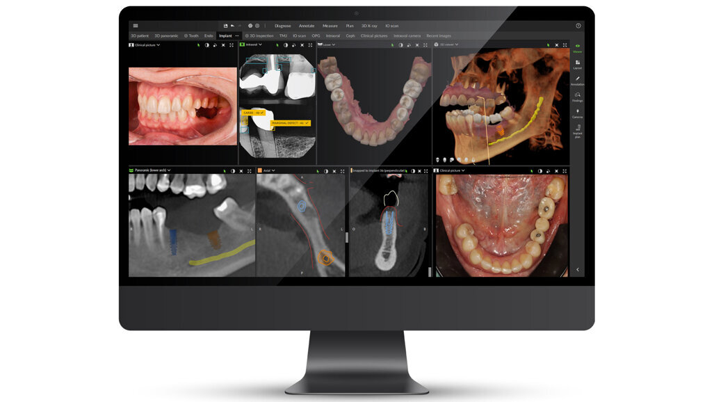 DEXIS presenta DTX Studio Clinic con funzionalità di intelligenza assistita