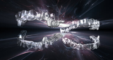 Smartee’s new S8 clear aligners correct severe Class II malocclusion