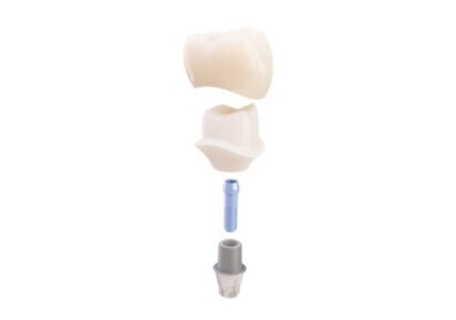TitaniumBase EV