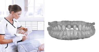 3Shape launches world’s first upgradable entry-level intra-oral scanner