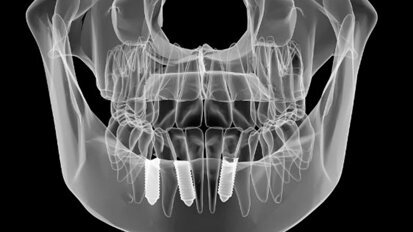 Emersa da una ricerca cinese una certa difformità tra la posizione reale e quella programmata di un impianto