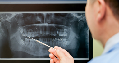 Neues SSO-Skript „Orale Chirurgie“ auch in italienischer Sprache
