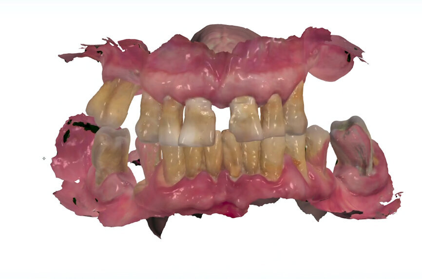 Fig. 3