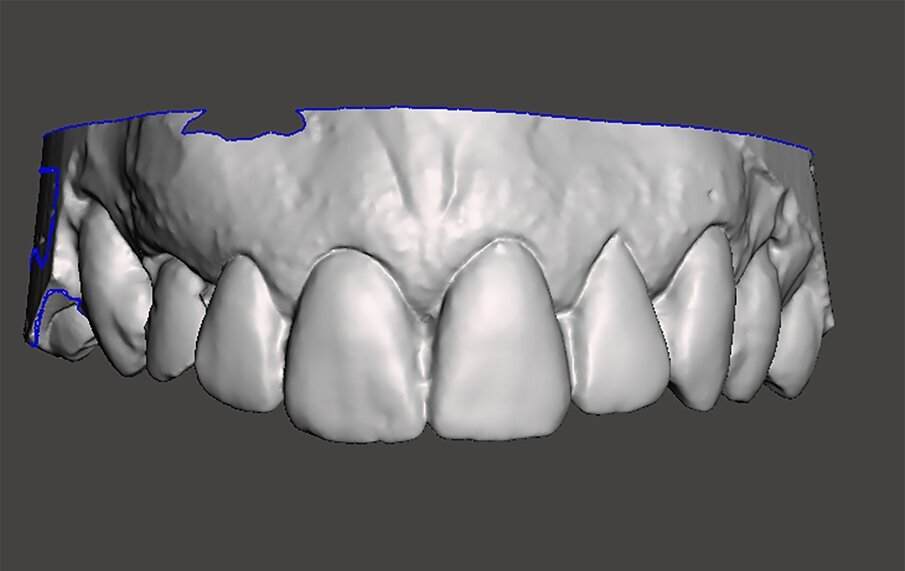 Fig. 7b