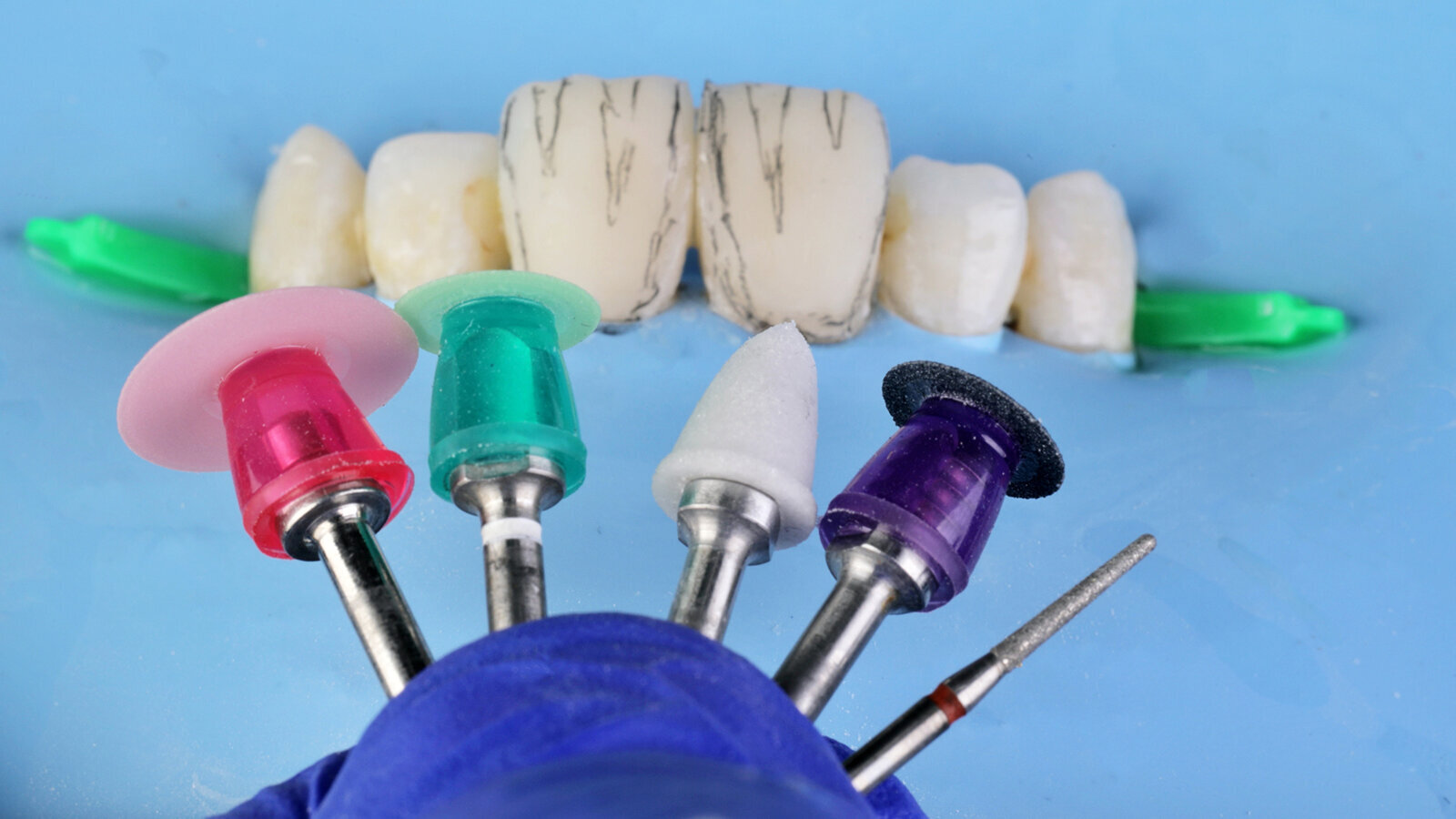 The MiCD approach to patient-centric smile enhancements