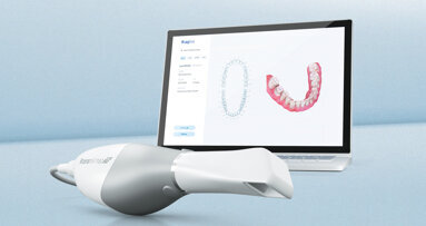 Ceramill DRS für interdisziplinäre, zukunftsorientierte Zusammenarbeit und schnelle Fertigung