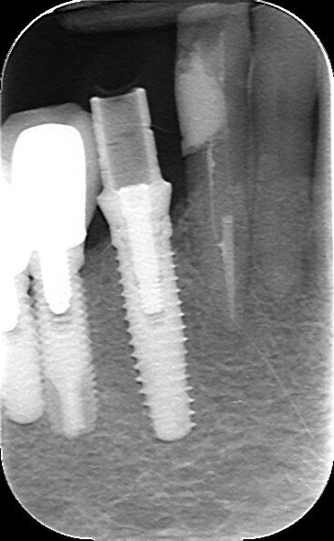 Fig. 13