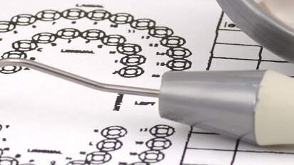 Aanvullende tandartsverzekering populairder