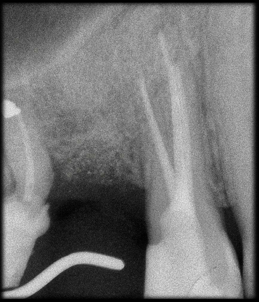Fig. 29