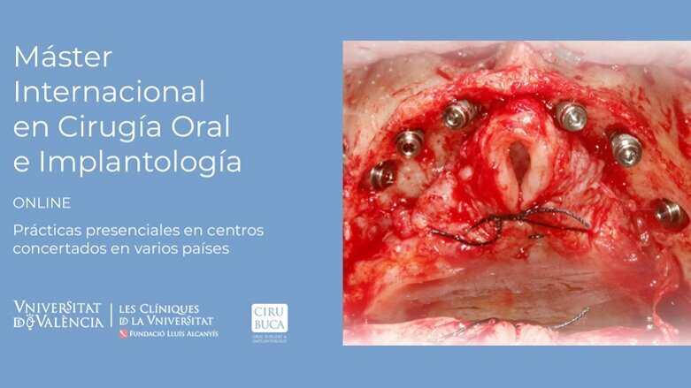 Primer Máster Internacional ONLINE en Cirugía Oral e lmplantología