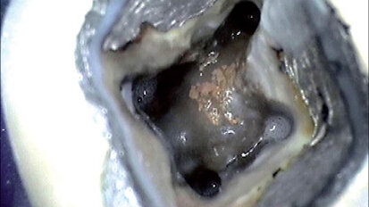 Když se příroda vysmívá endodontistům – dvě kazuistiky