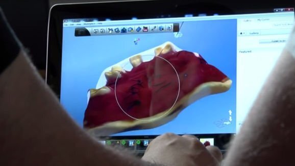 מכשיר סריקה הולוגרפית 3-D מקצר תהליך הולם תותבת באופן משמעותי
