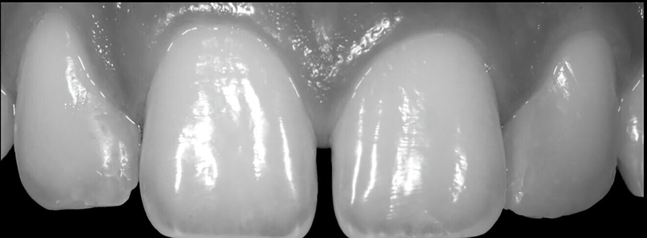 Fig. 2d