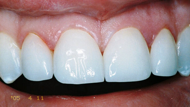 Healthy and harmonised function via computer-guided occlusal force management