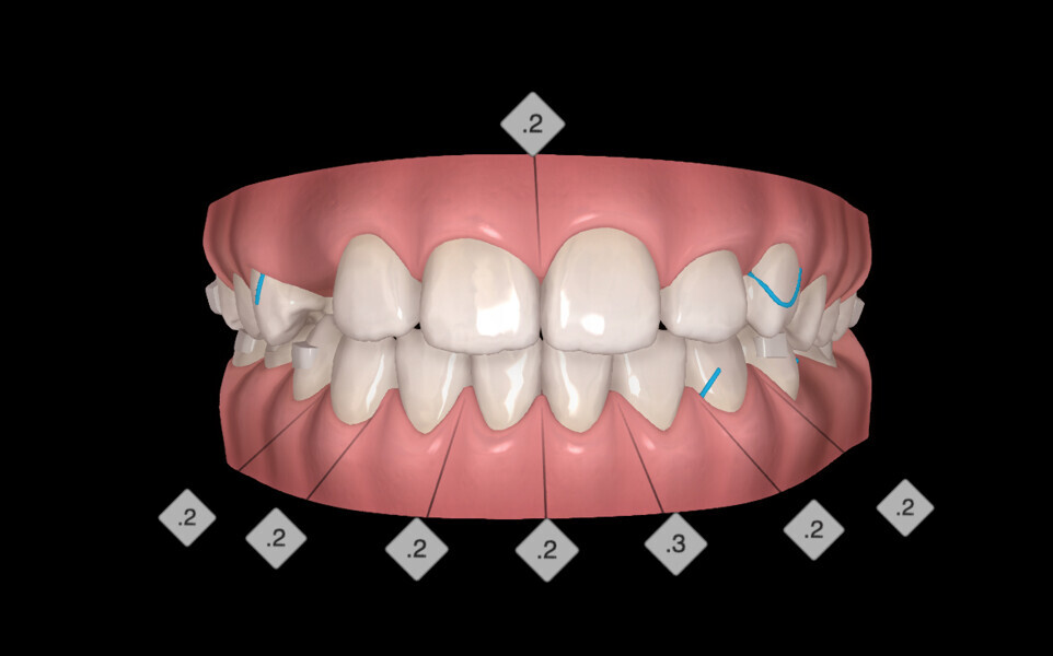 Fig. 16