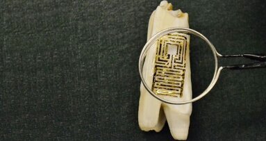 New biosensor on tooth enamel recognizes dental superbugs