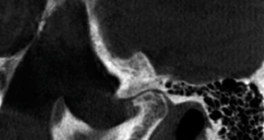 CBCT: ultimi abstracts riportati dalla letteratura