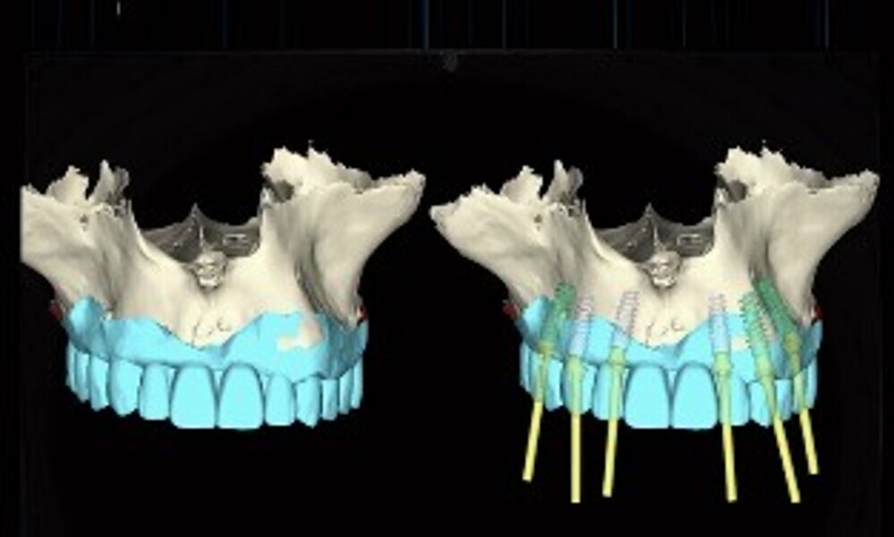 Fig. 15