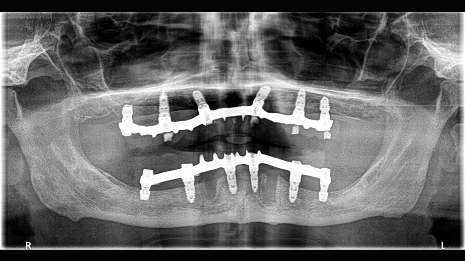 Fig. 13