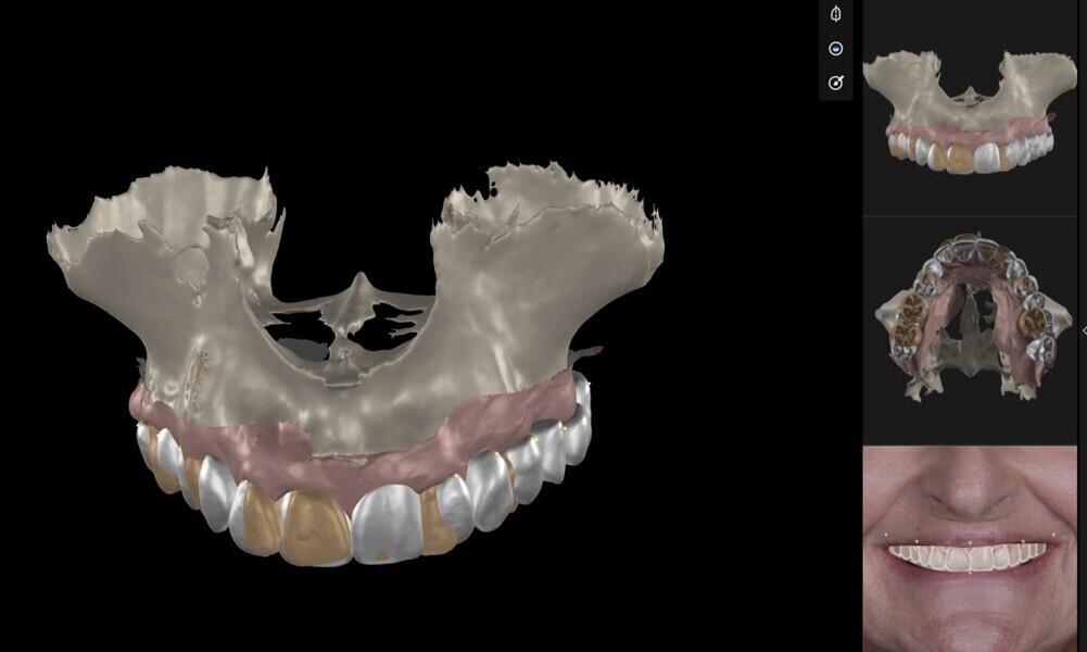 Fig. 13