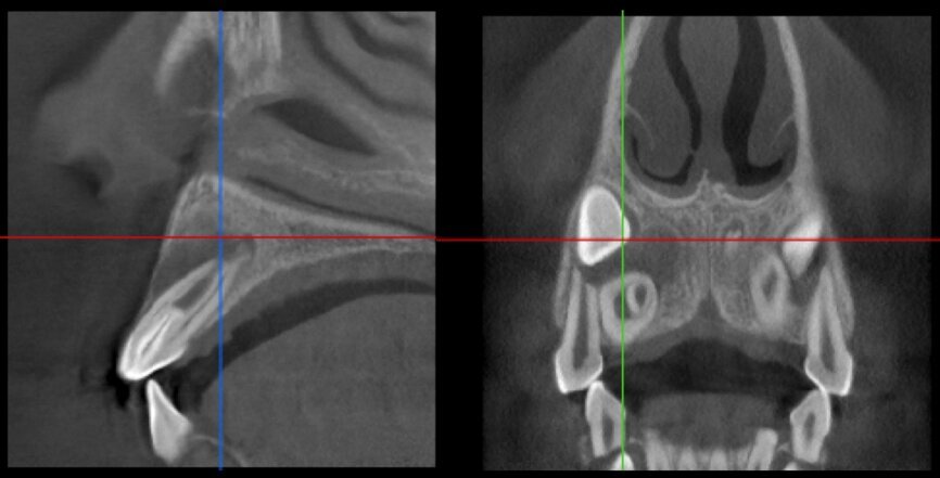 Fig. 33