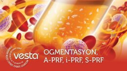 Ogmentasyon, A-PRF, i-PRF, S-PRF