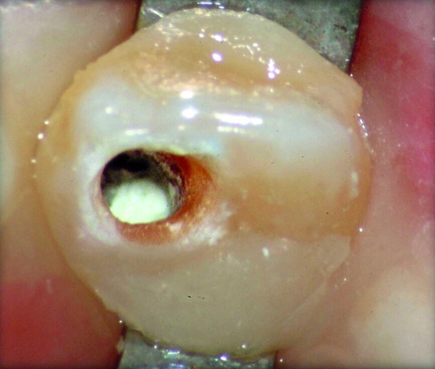 Figure 35