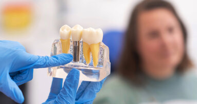 New implant prognosis model shows strong five-year predictive value