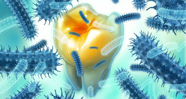 Study offers new insight into diversity and prevalence of bacteria in oral infections