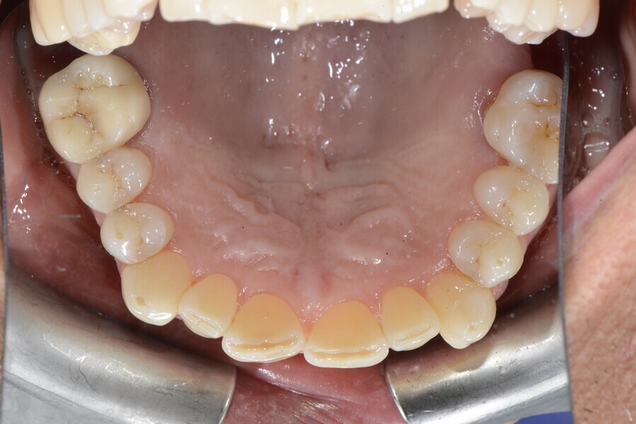 Fig. 17e