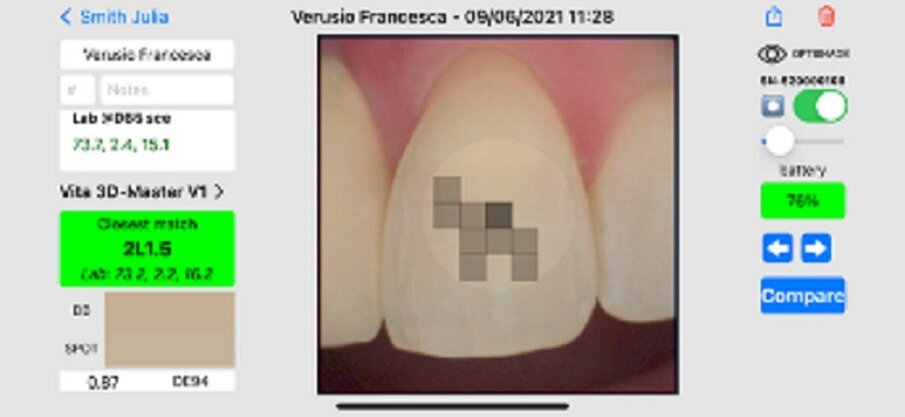 Fig. 15: Desired shade (neighbouring tooth).