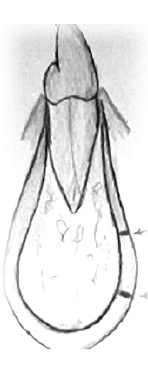 Ilustracion 3