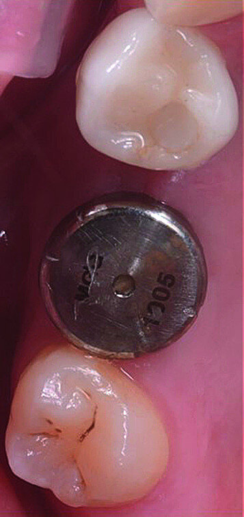 Fig. 15a