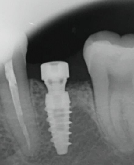 Fig. 3c