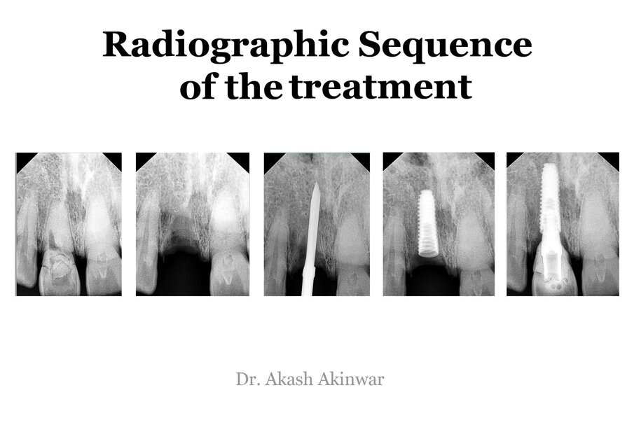 Fig 28