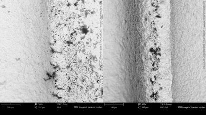 Sterile and yet dirty?Quality deficiencies of sterile-packaged ceramic and titanium implants