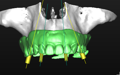 Fig. 15