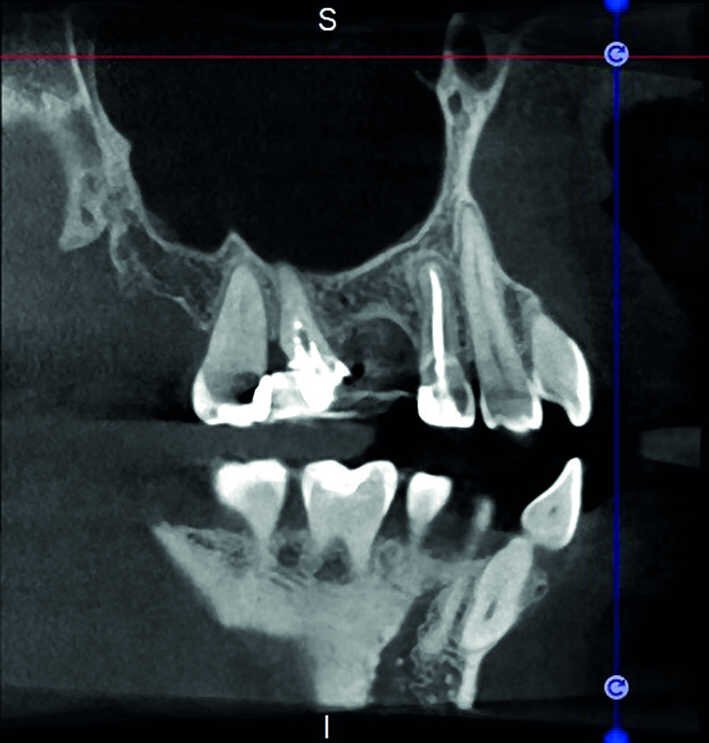 Figure 30