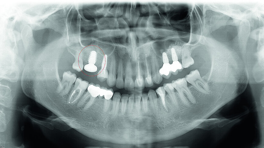 Fig. 9