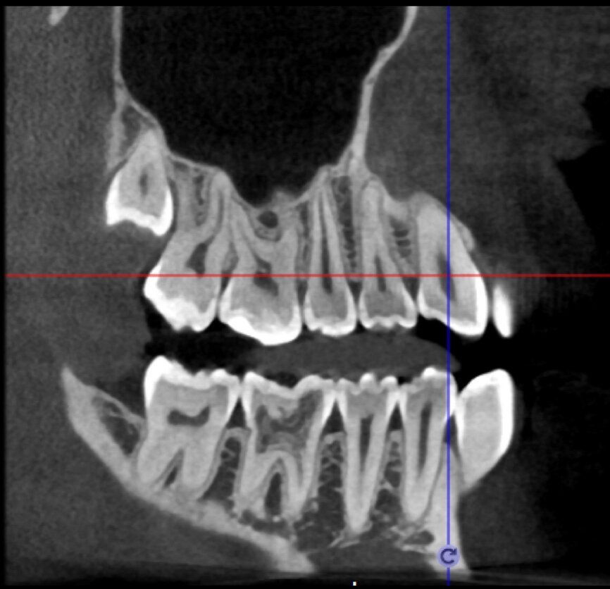 Fig. 22