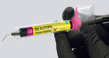 Inject and shape for easier, faster, stronger restorations