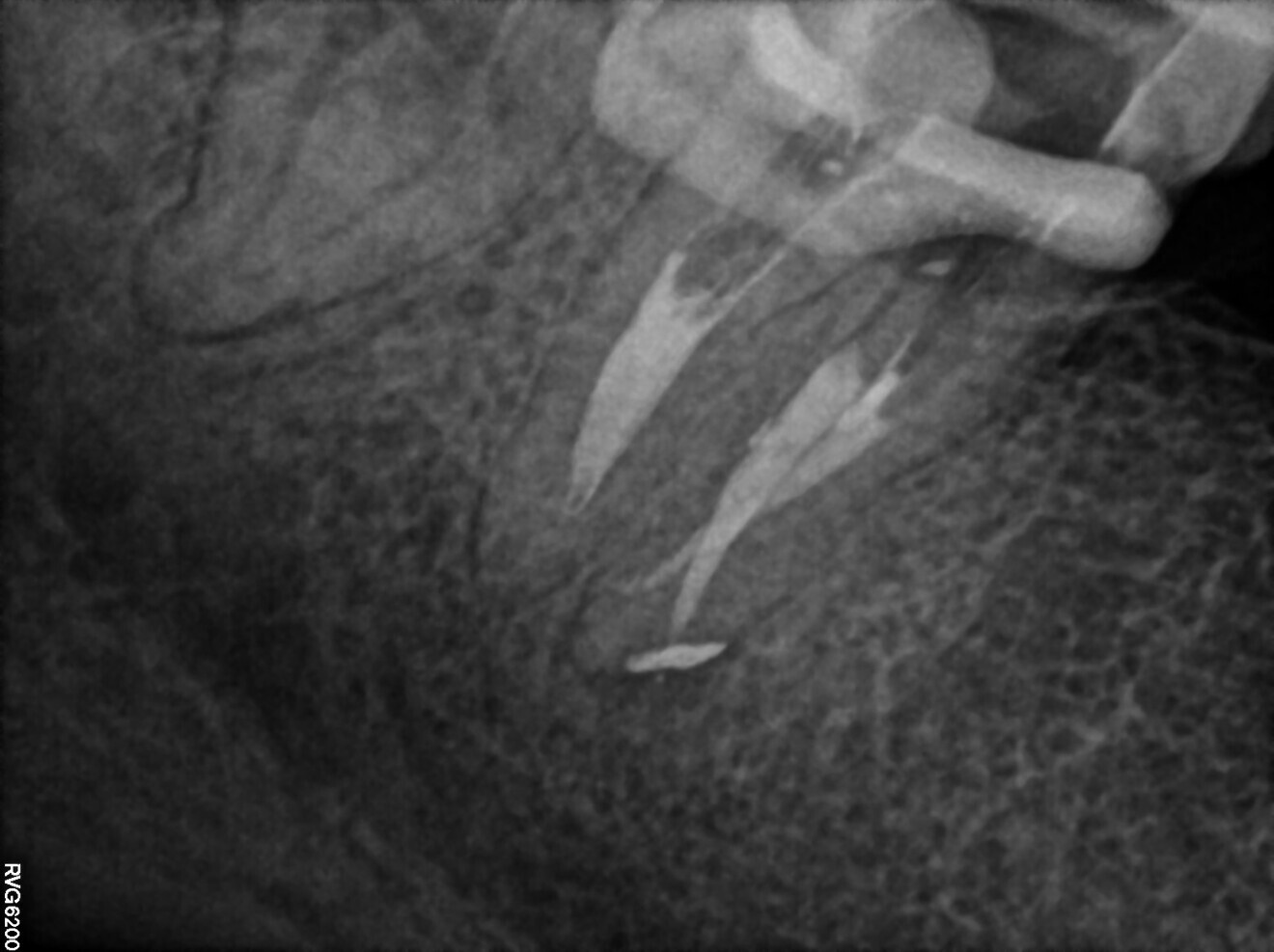 Fig. 20