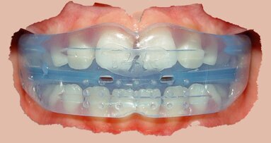 ¿Debe la industria dental determinar el futuro de la Ortodoncia?