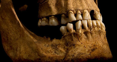 Teeth reveal details of Richard III’s lifestyle