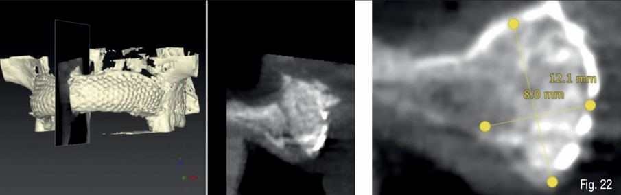 Fig. 22