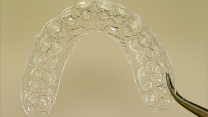 eCligner—aesthetic orthodontic appliance