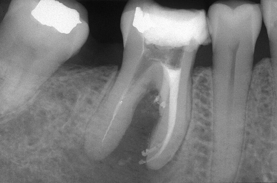 Fig. 3f