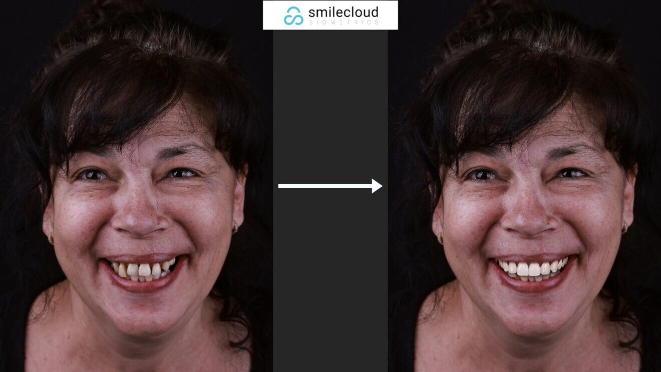 Fig. 5: Facial analysis and smile design.