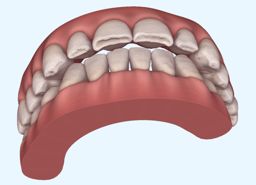 Fig. 18f