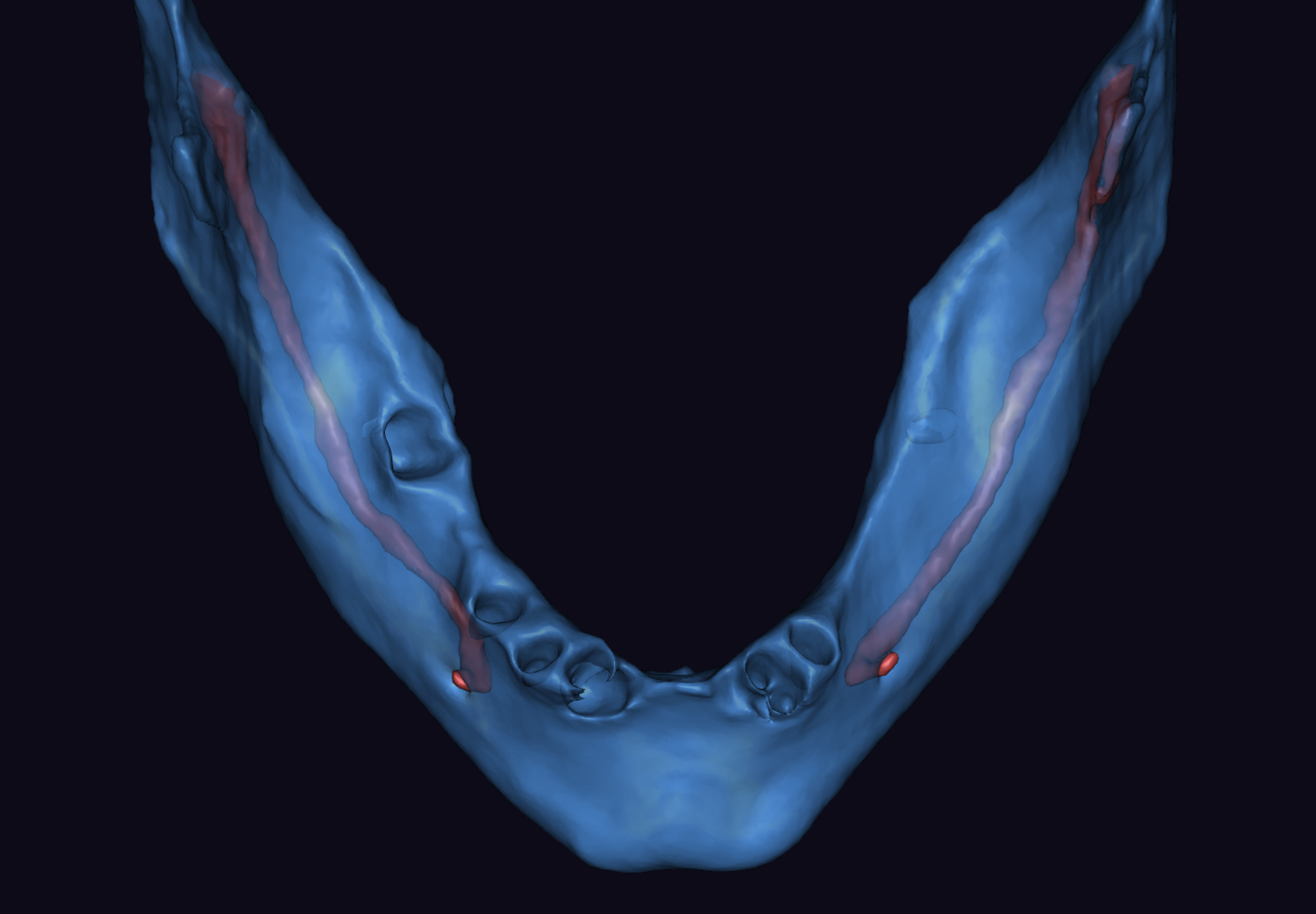 Fig. 3b